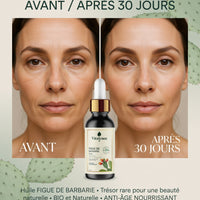 🔥 Huile de Figue de Barbarie BIO – Anti-Âge Naturel Puissant | Peau Lisse, Hydratée & Éclatante – 30 ml