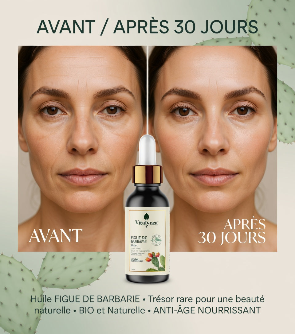 🔥 Huile de Figue de Barbarie BIO – Anti-Âge Naturel Puissant | Peau Lisse, Hydratée & Éclatante – 30 ml